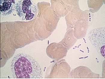 Bacillo della peste, Pasteurella Pestis